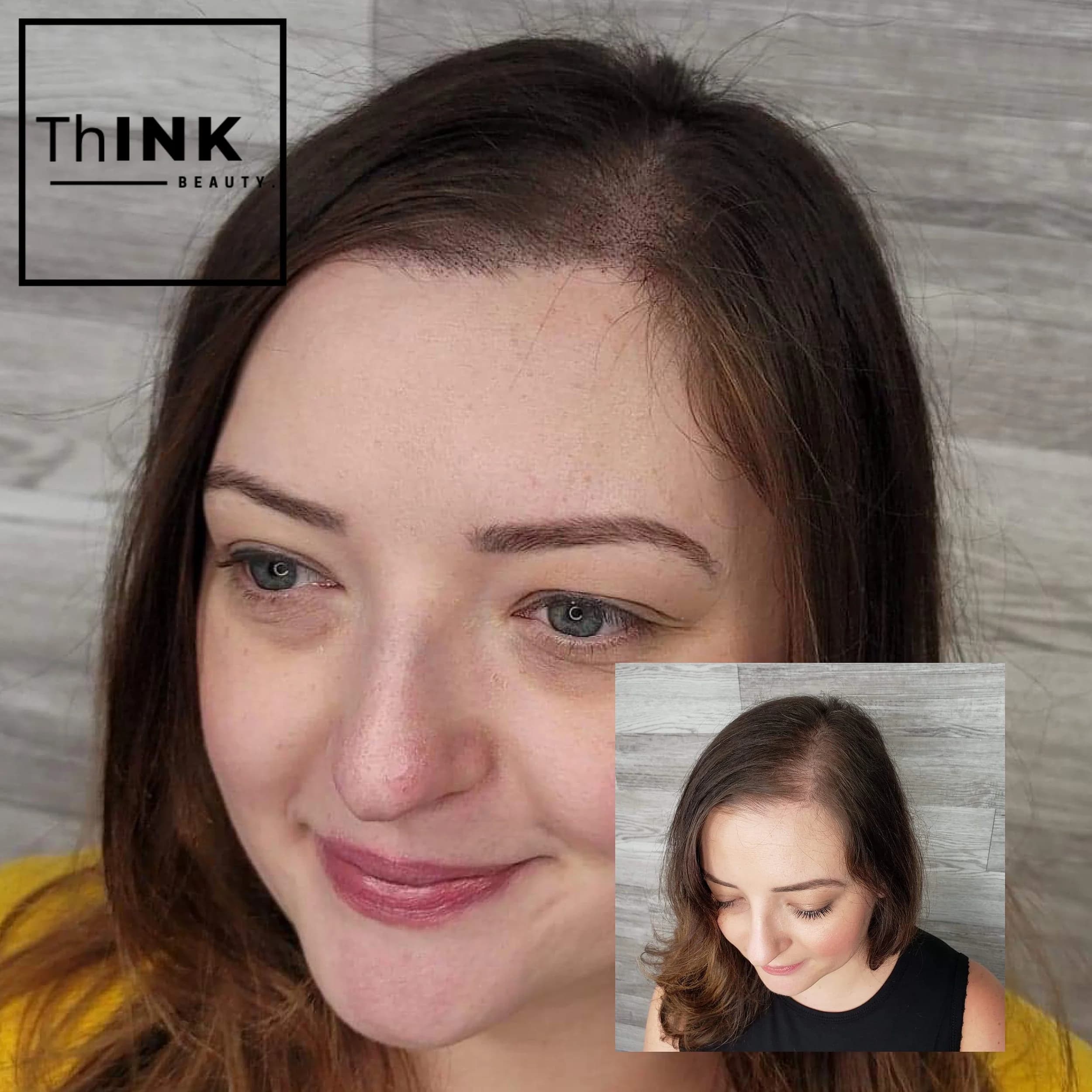 A female client before density work through the part line