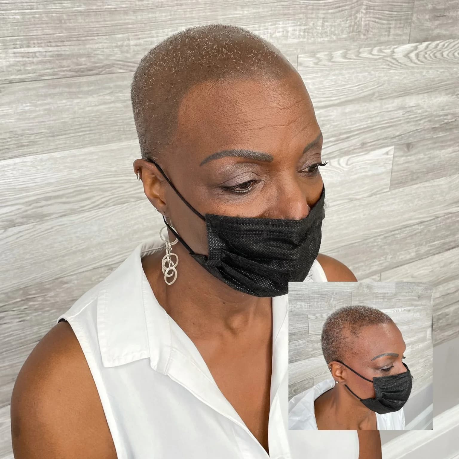 Scalp micropigmentation density on closely cropped hair