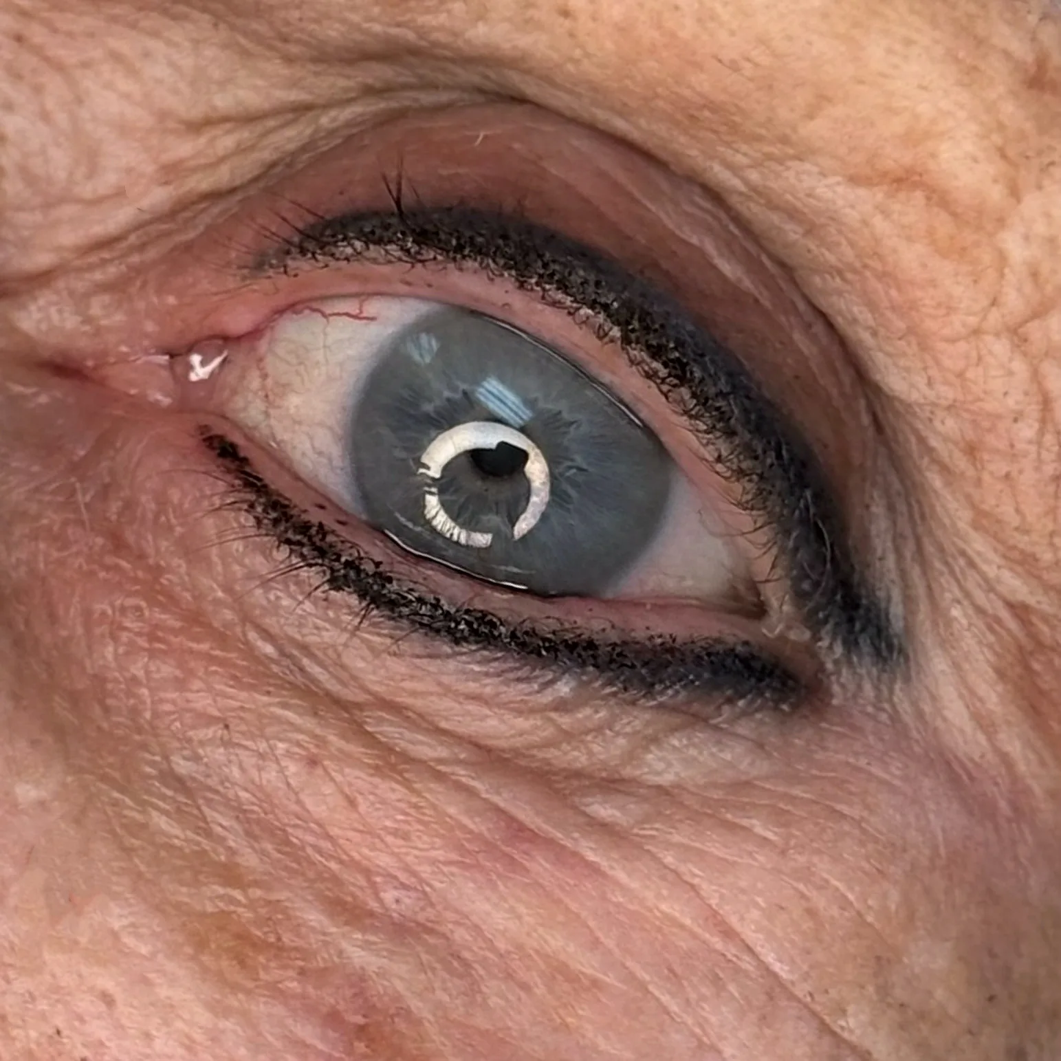 Defined upper and lower liner framing a blue eye