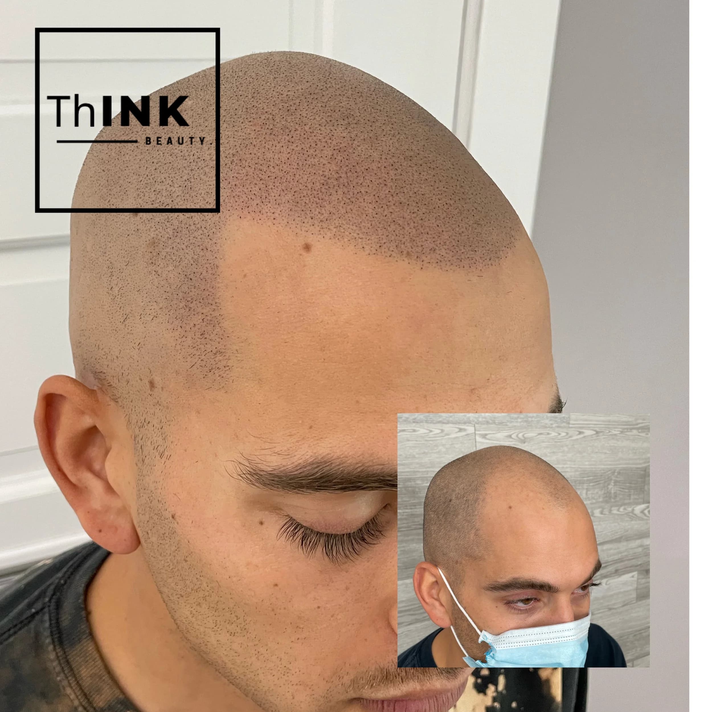 SMP density through a thinning front, before shot inset
