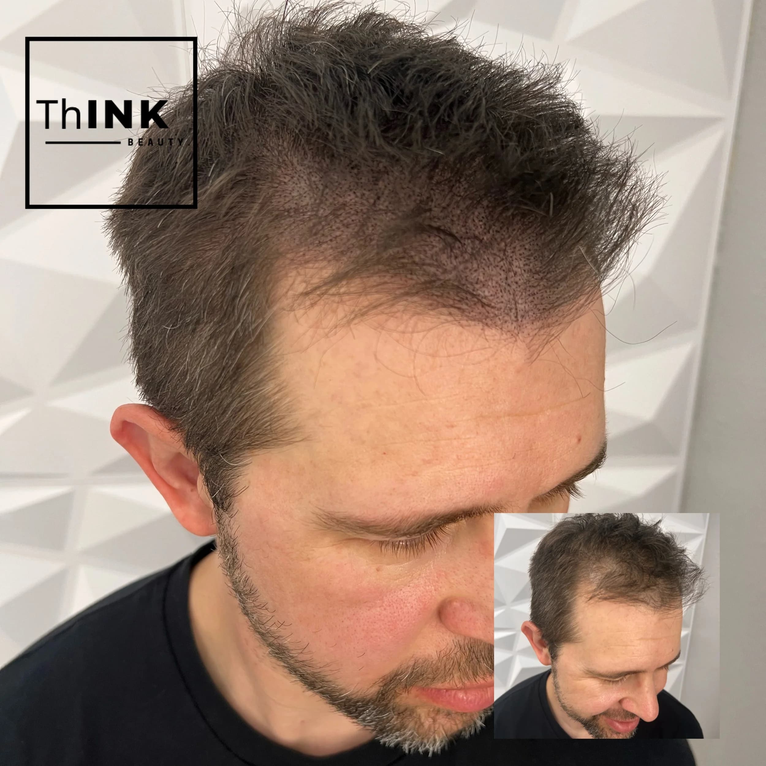 Added density blended into a client's remaining hair