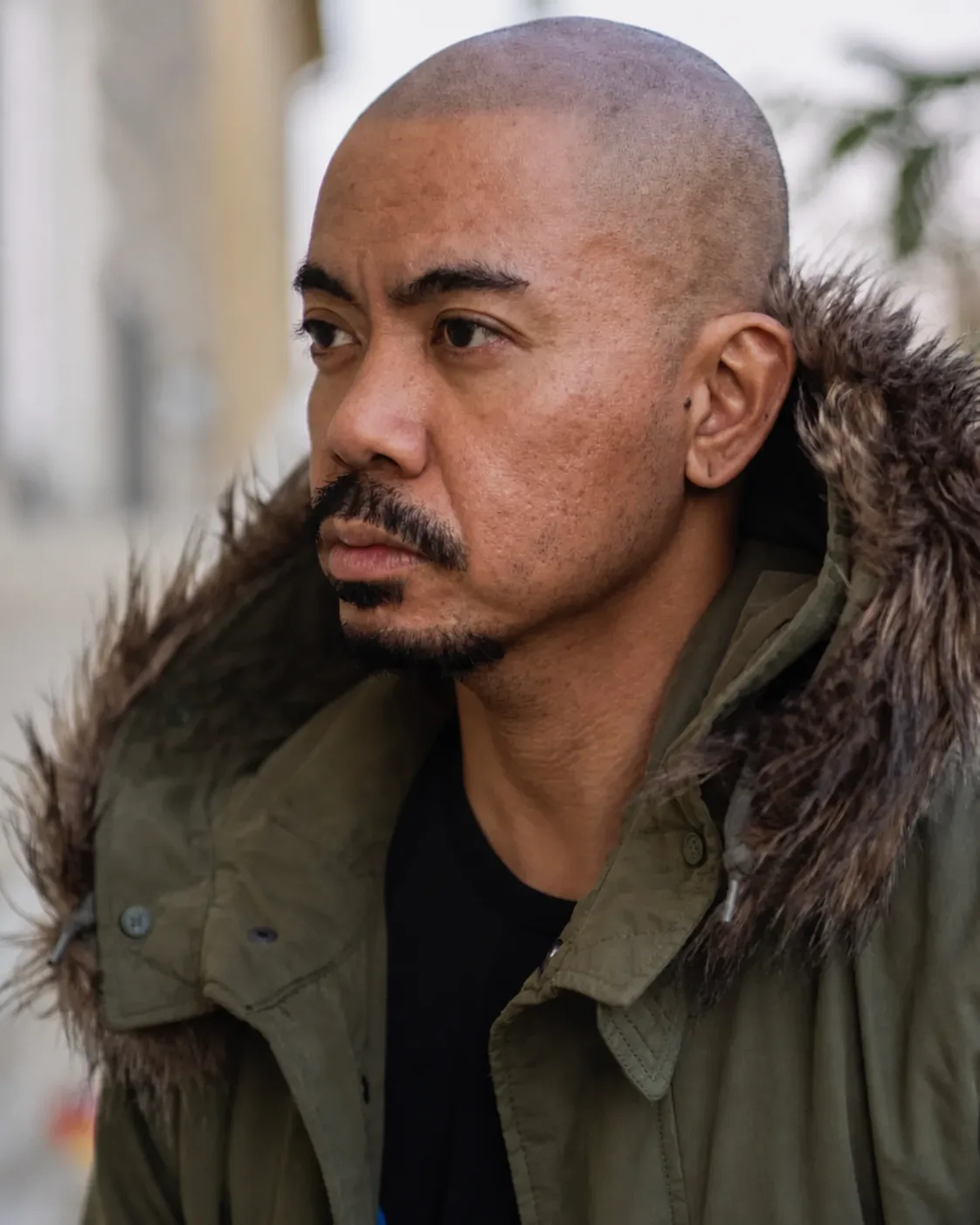 A scalp micropigmentation client with a natural, defined hairline